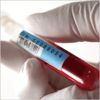 血小板血漿のイメージ写真