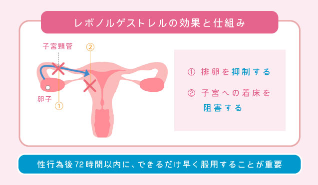 レボノルゲストレル錠の効果と仕組み