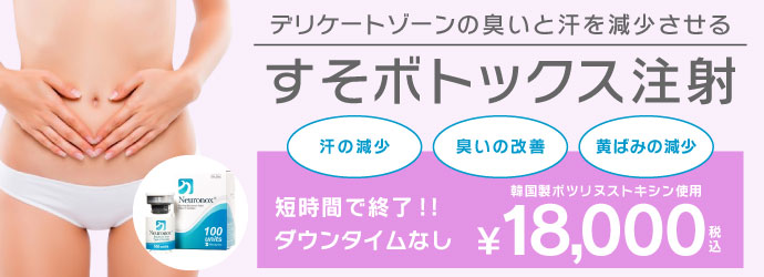 すそわきが治療・すそボトックス注射