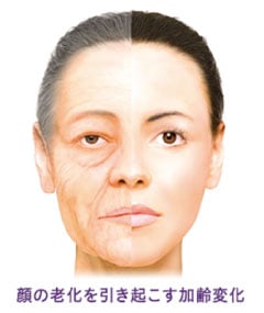 顔の老化を引き起こす加齢変化