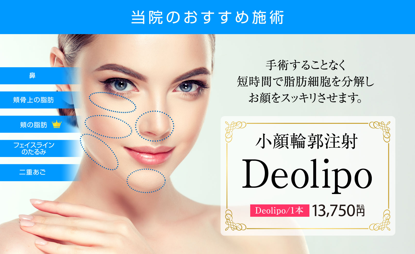 Deolipo（小顔輪郭注射）