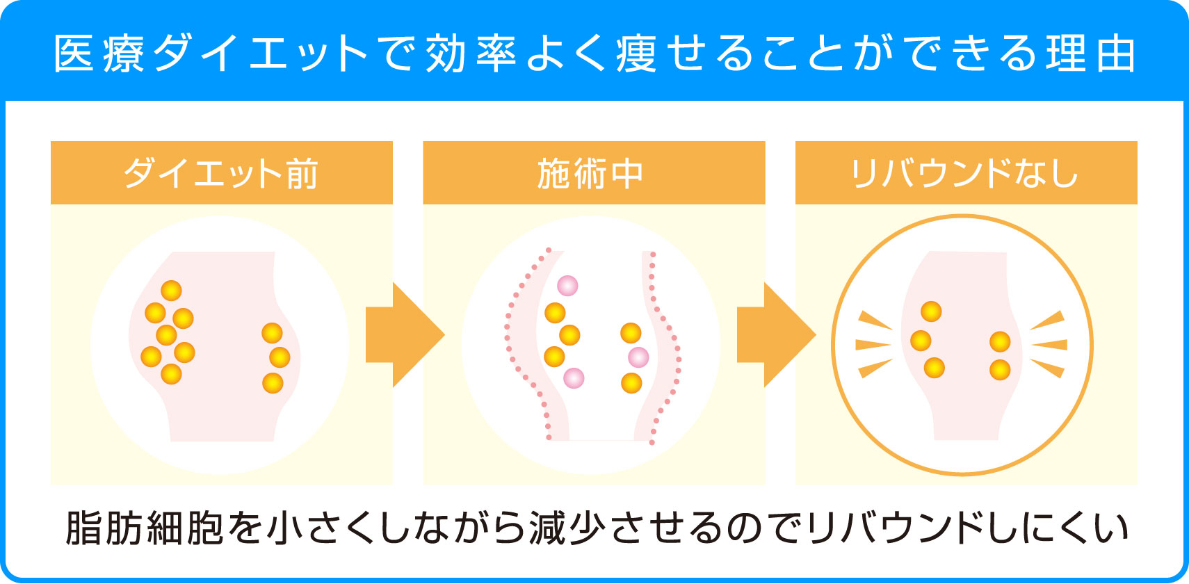 医療ダイエットで効率よく痩せることができる理由