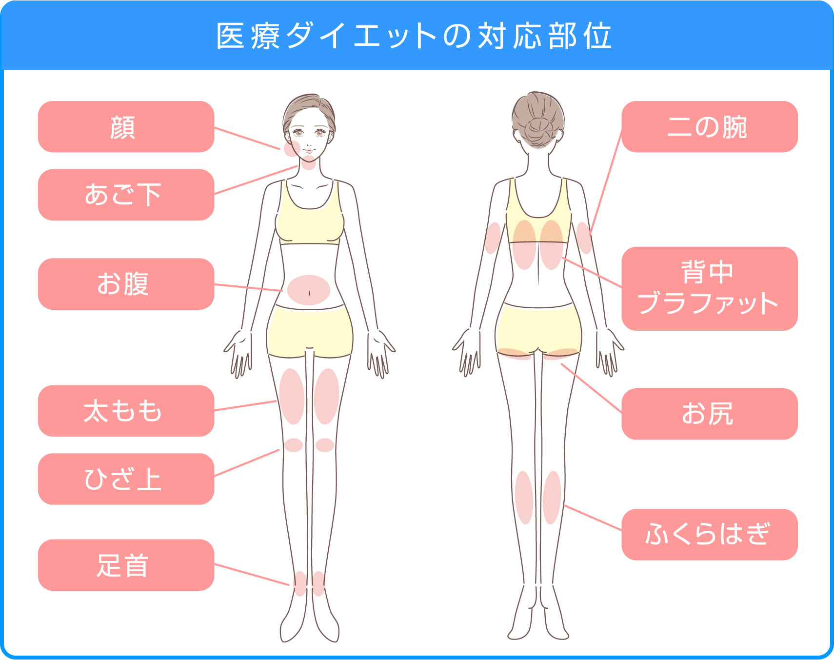 医療ダイエットの対応部位